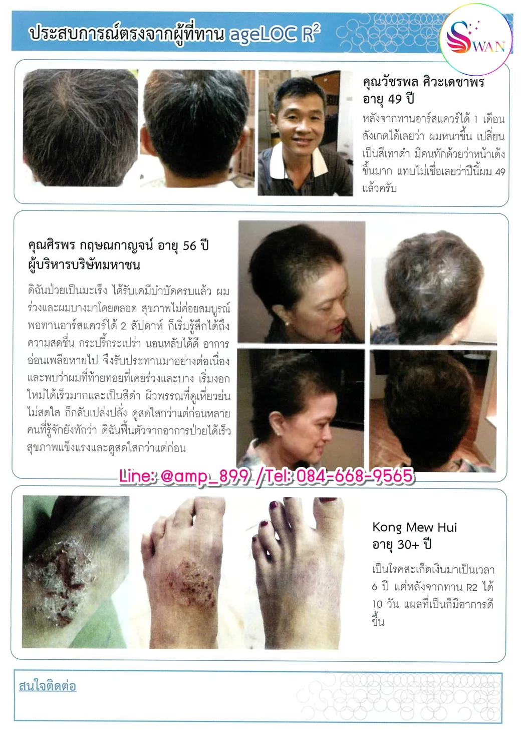 เอจล็อค อาร์สแควร์ นูสกิน รีวิวจากผู้ใช้จริง-2