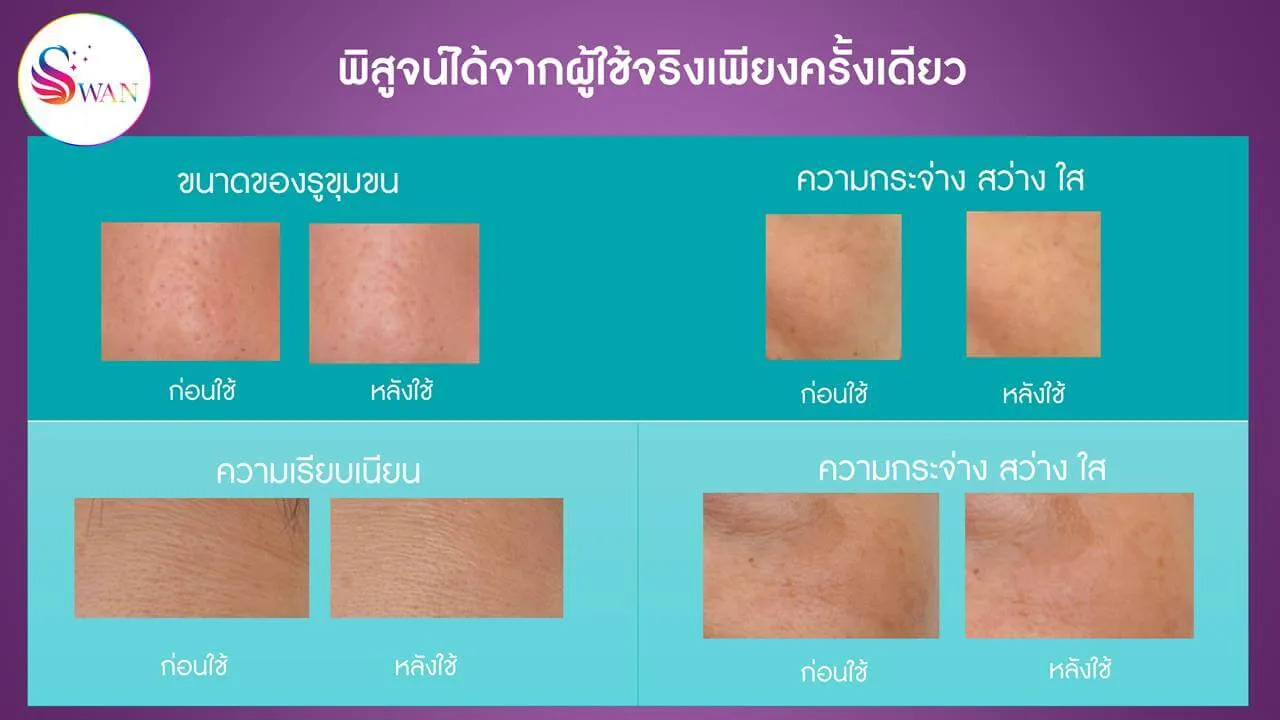 ageLOC Lumispa io Nuskin เห็นผลตั้งแต่ครั้งแรกที่ใช้