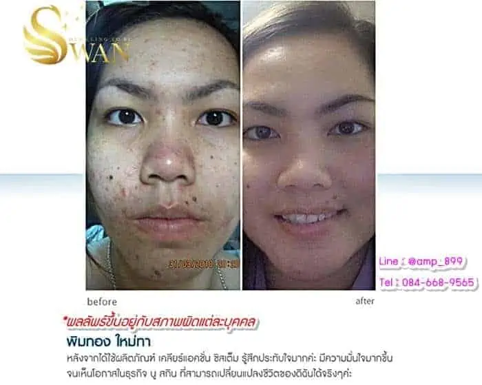 ชุดเคลียแอคชั่น ซิสเต็ม (Clear Action System)-นูสกิน-Nuskin-Test