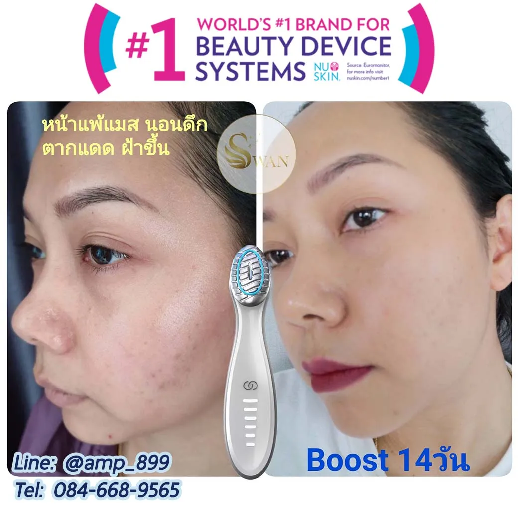 รีวิว ผลลัพธ์ใช้เครื่องนวดหน้านูสกิน Boost