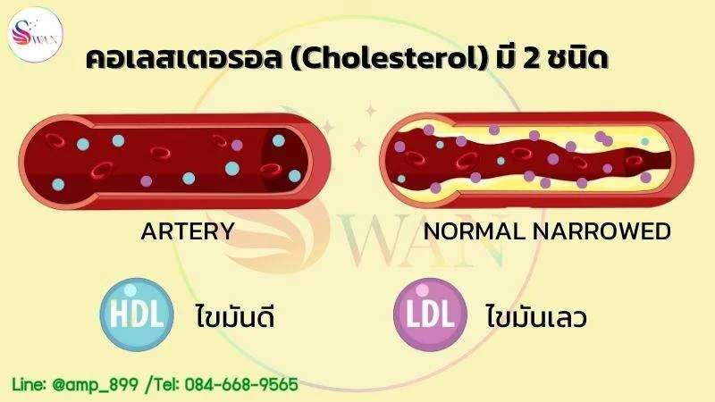 คอเลสเตอรอล (Cholesterol) มี 2 ชนิด