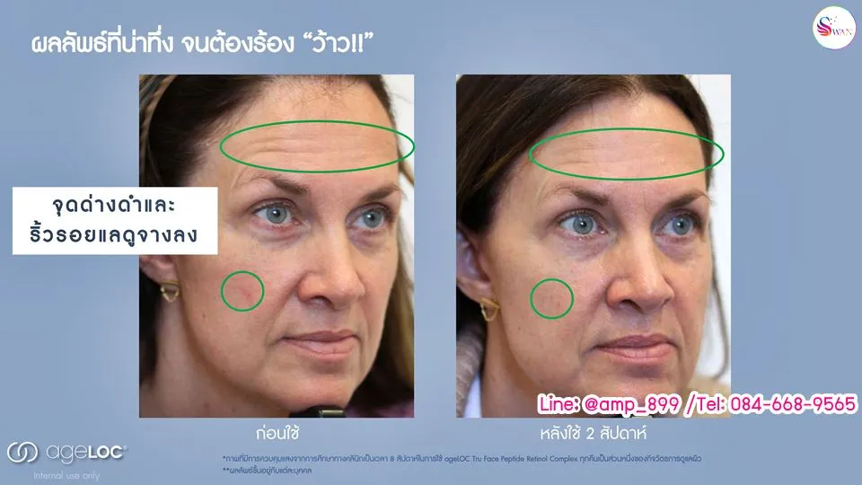 เอจล็อค ทรูเฟซ เปปไทด์ เรตินอล คอมเพล็กซ์ รีวิวหลังใช้ 2 สัปดาห์
