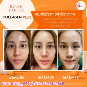รีวิวจากผู้ใช้จริง คอลลาเจน พลัส นูสกิน -5