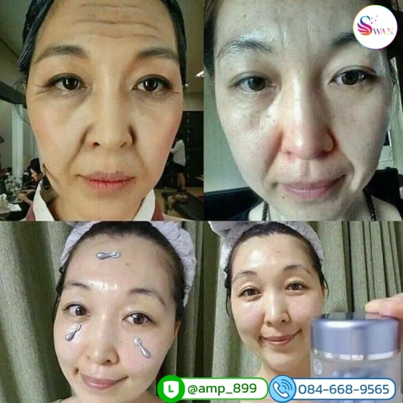ageLOC Tru Face Essence Ultra Nuskin รีวิวผลลัพธ์จากผู้ใช้จริง 3