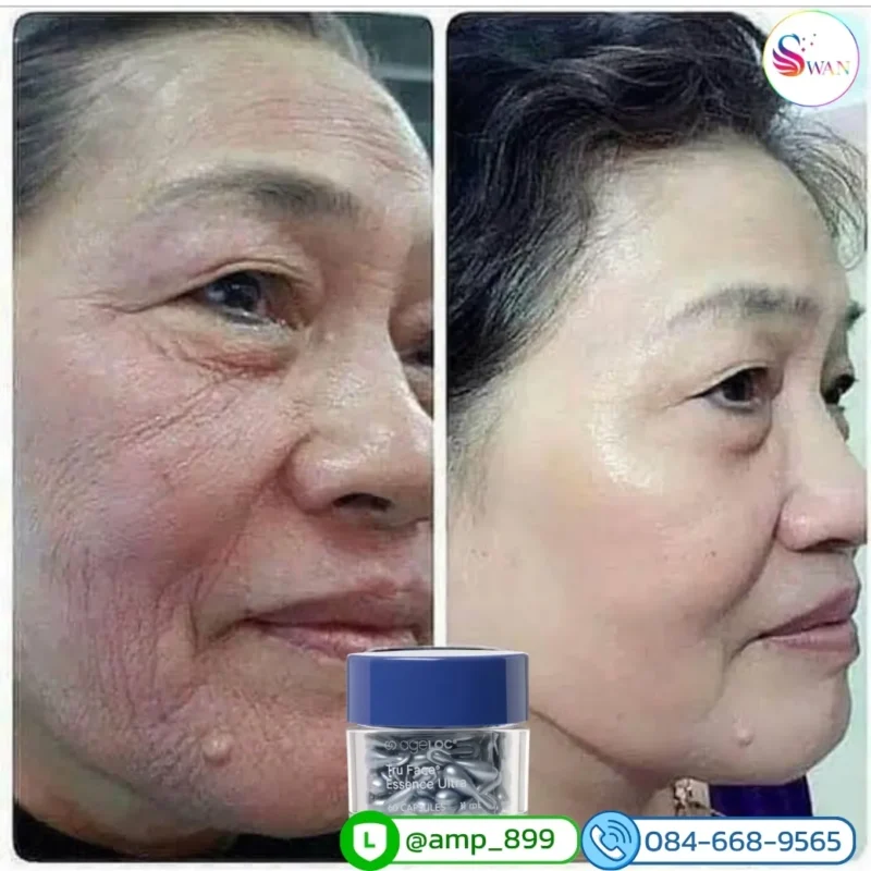 ageLOC Tru Face Essence Ultra Nuskin รีวิวผลลัพธ์จากผู้ใช้จริง 4