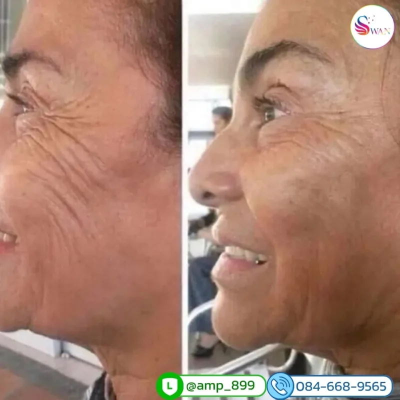 ageLOC Tru Face Essence Ultra Nuskin รีวิวผลลัพธ์จากผู้ใช้จริง 5