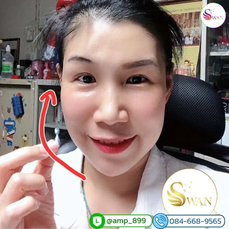 ageLOC Tru Face Essence Ultra Nuskin รีวิวผลลัพธ์จากผู้ใช้จริง 6